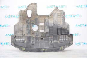 Защита двигателя Kia Forte 4d 17-18 рест, нет крышек