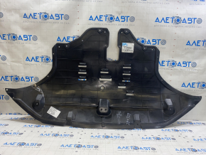 Захист двигуна Hyundai Santa Fe 19-20 2.0, 2.4
