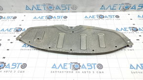 Защита двигателя задняя Hyundai Santa FE 19-23
