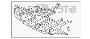 Защита двигателя Hyundai Elantra AD 17-20 2.0 примятости, трещины